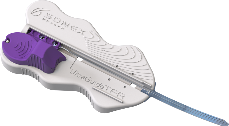 Sonex Health's UltraGuideTFR medical device